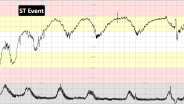 ST Case 10