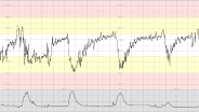 CTG Case 22